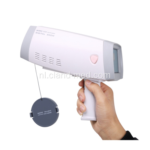 Handheld digitale Full hd-camera voor vagina-colposcoop